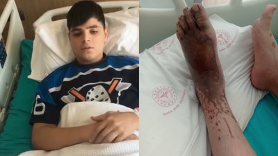 Fabrikada büyük ihmal: Tarlaya giden çocuk az daha ayaklarından oluyordu