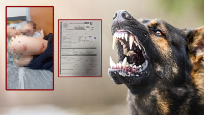 Sokak köpekleri faciaya neden oluyordu: Komşular yetişmeseydi parçalayacaklardı