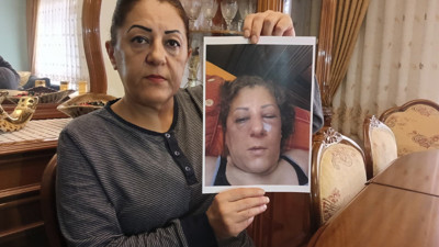 Bahçedeki kedileri besledi diye komşusunun saldırısına uğradı! Talihsiz kadının burnu kırıldı