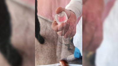 Havadan bırakılan kuduz aşısı paniğe neden oldu! Kapı kapı gezip fotoğraf göstererek tehlikeye dikkat çektiler