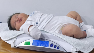 6 Kilo 150 gramla Türkiye rekoru: Ali Atilla bebek dünyaya geldi