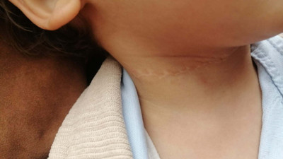 1,5 yaşındaki çocuğun boynunu kesen sanığa 21,5 yıl hapis