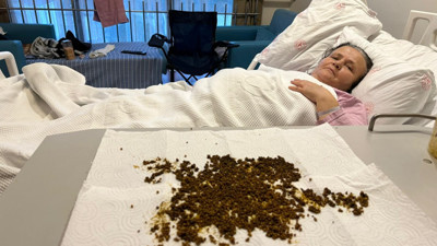 Karın ağrısı şikayetiyle gitti tıp dünyasını şoke etti! Çıkan taşları yapay zekaya saydırabildiler