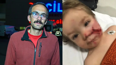 Ankara’da pitbull dehşeti! 1,5 ve 5 yaşındaki çocuklar yaralandı, sahibi yakalandı