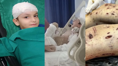 Ankara'da başıboş köpek saldırısı: Tunahan'ın ailesine 5 milyon TL tazminat