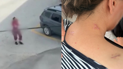 17 bıçak darbesi alıp ölü numarasıyla kurtuldu: Talihsiz kadının tek bir isteği var