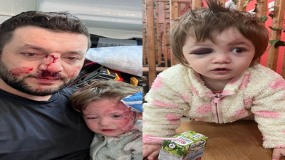 Kucağında bebeği olan babayı darbeden sanık adli kontrolle tahliye edildi