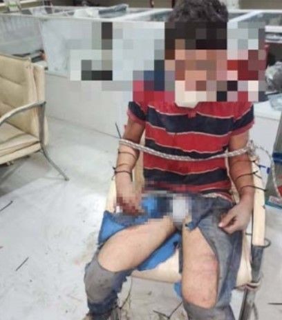 Antalya'da kan donduran olay! Maaşını istedi diye dişlerini kerpetenle söküp böcek yedirdiler - Resim: 8