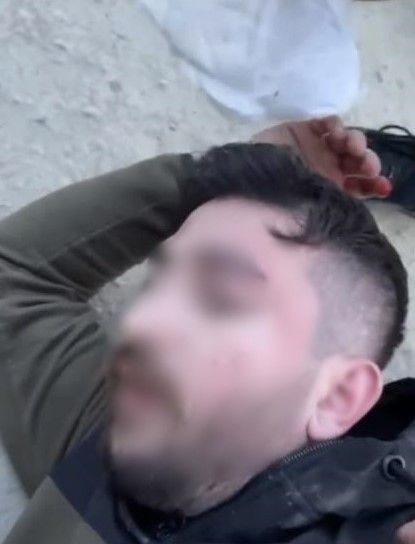İstanbul'da baltalı dehşet! Kafasına vurulan genç felç kaldı! O anlar kamerada - Resim: 6