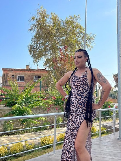 Fenomen isim Mükremin, yaptırdığı estetik operasyonla dillere düştü - Resim: 2