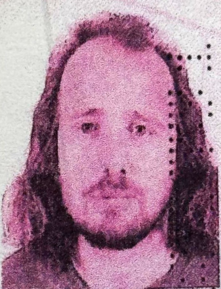 Türkiye'ye saç ekimi ve diş tedavisi için gelen İngiliz hayatını kaybetti - Resim : 1