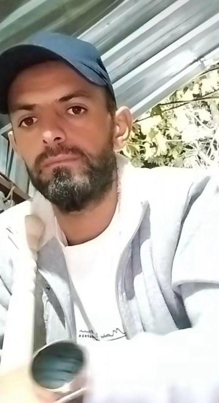 Esenyurt'ta boşanma aşamasındaki eşinin ailesine kezzapla saldıran şüpheli tutuklandı - Resim: 7