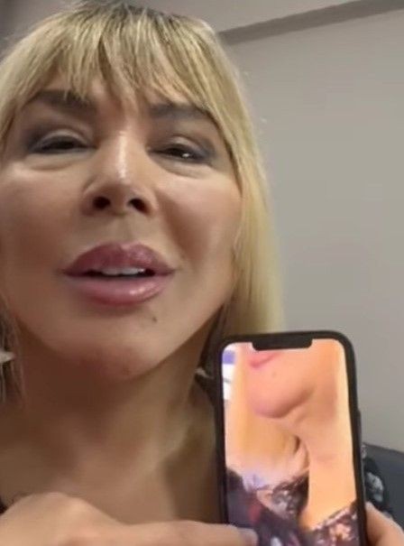 Geçirdiği operasyonlarla bambaşka birine dönüşen Safiye Soyman'a bir bakın! Son halini görenler gözlerine inanamadı! "Bu gerçekten Safiye Soyman mı?" - Resim: 6