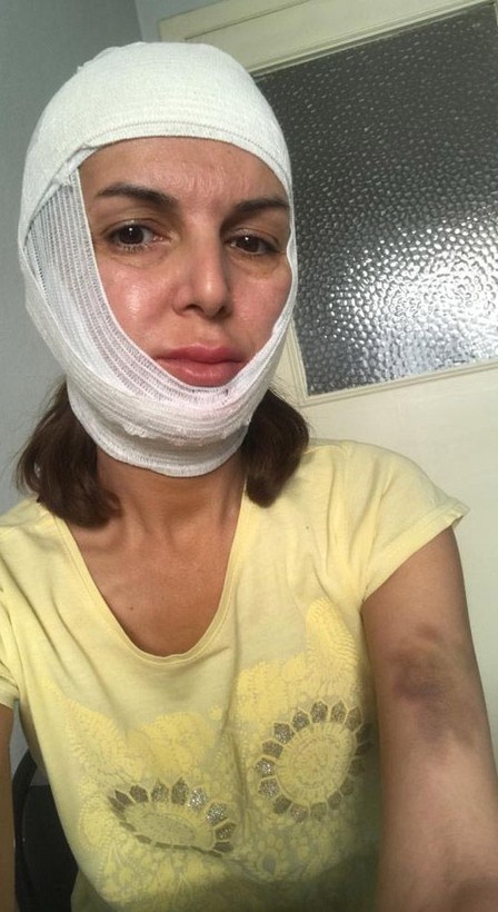 Topuklu sesi yüzünden çalışanını öldüresiye dövdü - Resim: 3