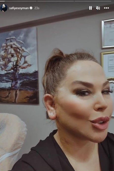Geçirdiği operasyonlarla bambaşka birine dönüşen Safiye Soyman'a bir bakın! Son halini görenler gözlerine inanamadı! "Bu gerçekten Safiye Soyman mı?" - Resim: 13