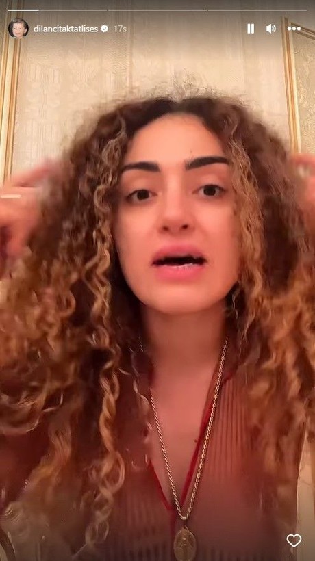 Dilan Çıtak Tatlıses "Konuşmayayım..." diye başladıktan sonra açtı ağızını yumdu gözünü! Tatlıses'ten dikkat çeken isyan: Otobüste kadının arkasından dokunan... - Resim: 4