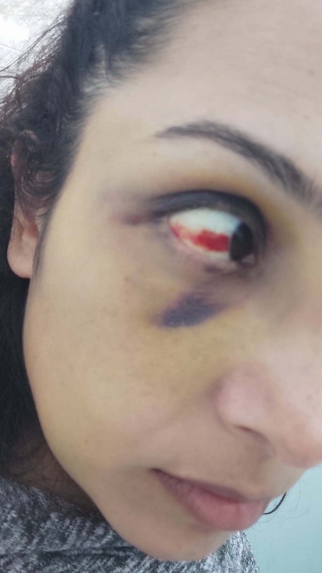 Burcu öğretmenin yardım feryadı: Kurtarın beni - Resim: 5