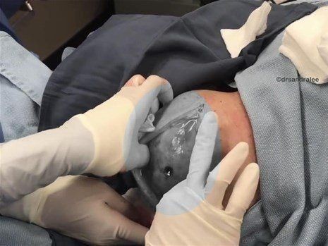 Boynundaki kocaman şişlikten çıkanlar mide bulandırdı! 'Doktor Çıban' bile gözlerine inanamadı - Resim: 10