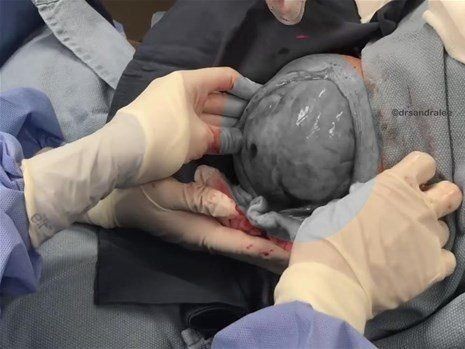 Boynundaki kocaman şişlikten çıkanlar mide bulandırdı! 'Doktor Çıban' bile gözlerine inanamadı - Resim: 12