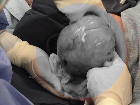 Boynundaki kocaman şişlikten çıkanlar mide bulandırdı! 'Doktor Çıban' bile gözlerine inanamadı - Resim: 13
