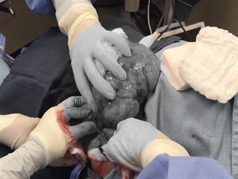Boynundaki kocaman şişlikten çıkanlar mide bulandırdı! 'Doktor Çıban' bile gözlerine inanamadı - Resim: 17