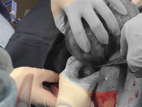 Boynundaki kocaman şişlikten çıkanlar mide bulandırdı! 'Doktor Çıban' bile gözlerine inanamadı - Resim: 18