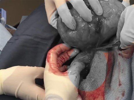 Boynundaki kocaman şişlikten çıkanlar mide bulandırdı! 'Doktor Çıban' bile gözlerine inanamadı - Resim: 19