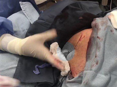 Boynundaki kocaman şişlikten çıkanlar mide bulandırdı! 'Doktor Çıban' bile gözlerine inanamadı - Resim: 21