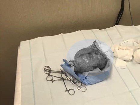 Boynundaki kocaman şişlikten çıkanlar mide bulandırdı! 'Doktor Çıban' bile gözlerine inanamadı - Resim: 27