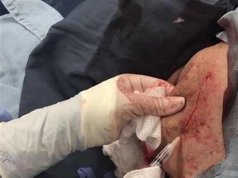 Boynundaki kocaman şişlikten çıkanlar mide bulandırdı! 'Doktor Çıban' bile gözlerine inanamadı - Resim: 28