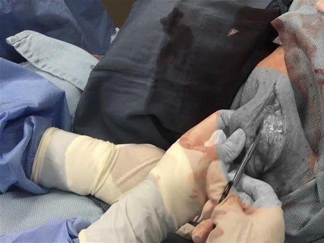 Boynundaki kocaman şişlikten çıkanlar mide bulandırdı! 'Doktor Çıban' bile gözlerine inanamadı - Resim: 30