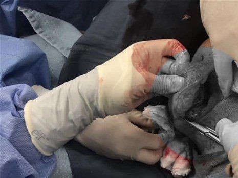 Boynundaki kocaman şişlikten çıkanlar mide bulandırdı! 'Doktor Çıban' bile gözlerine inanamadı - Resim: 31