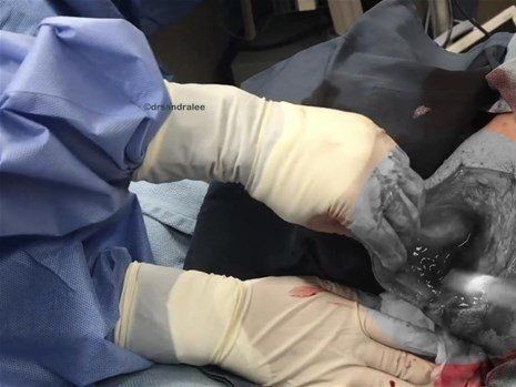 Boynundaki kocaman şişlikten çıkanlar mide bulandırdı! 'Doktor Çıban' bile gözlerine inanamadı - Resim: 32