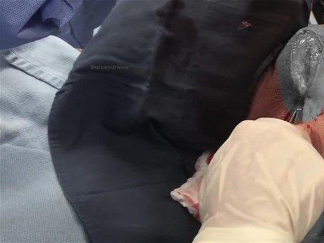Boynundaki kocaman şişlikten çıkanlar mide bulandırdı! 'Doktor Çıban' bile gözlerine inanamadı - Resim: 34