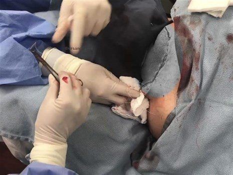 Boynundaki kocaman şişlikten çıkanlar mide bulandırdı! 'Doktor Çıban' bile gözlerine inanamadı - Resim: 37