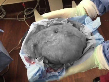Boynundaki kocaman şişlikten çıkanlar mide bulandırdı! 'Doktor Çıban' bile gözlerine inanamadı - Resim: 42