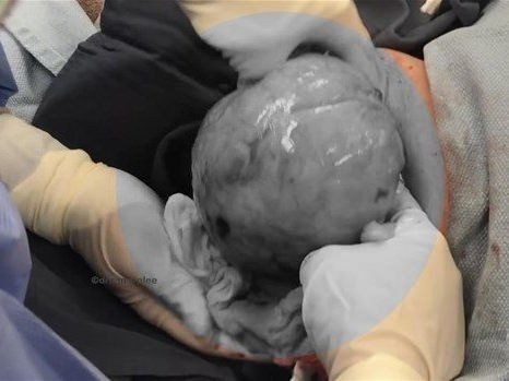 Boynundaki kocaman şişlikten çıkanlar mide bulandırdı! 'Doktor Çıban' bile gözlerine inanamadı - Resim: 14