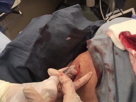 Boynundaki kocaman şişlikten çıkanlar mide bulandırdı! 'Doktor Çıban' bile gözlerine inanamadı - Resim: 23