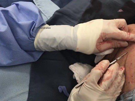 Boynundaki kocaman şişlikten çıkanlar mide bulandırdı! 'Doktor Çıban' bile gözlerine inanamadı - Resim: 26