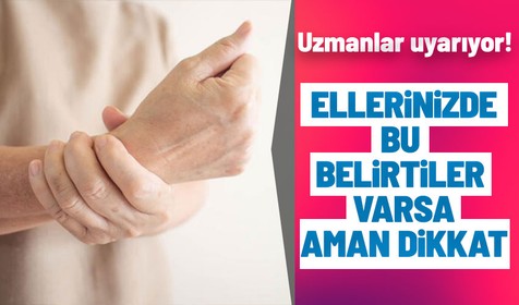 Uzmanlar uyarıyor: El deyip geçmeyin! Ellerde bu belirtiler varsa mutlaka kontrol ettirin