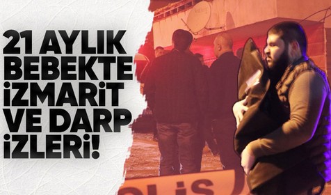 Denizli'de ölü olarak bulunan 21 aylık Murat Aslan bebeğin vücudunda darp ve izmarit izlerine rastlandı