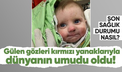 Gülen gözleri kırmızı yanaklarıyla dünyanın umudu oldu! Mucize bebek mucize kurtuluşuyla şoke etti! Son sağlık durumu ne?