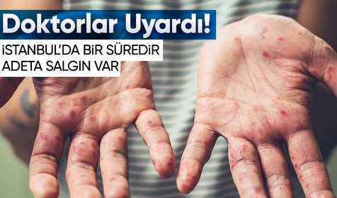 Uzman doktor 'İstanbul'dan çok fazla vaka bildirimi gelmeye başladı' diyerek kızamık konusunda uyardı!