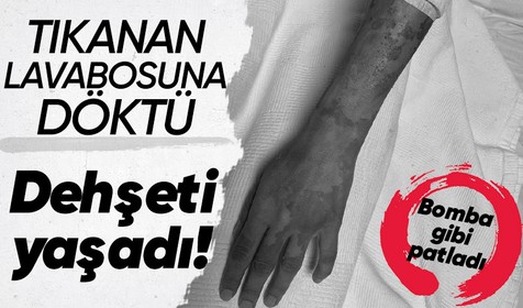 Sultangazi'de tıkanan lavabosunu açmak isteyen genç kızın döktüğü sıvı bomba gibi patladı! Kıyafetleri paramparça oldu