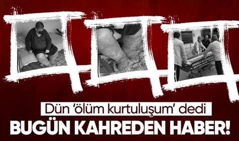 Denizli'den Antalya'ya çalışmak için gittiği otelde sivrisinek ısırması sonucu fil ayağı hastalığına yakalanan güvenlik görevlisi hayata tutunamadı
