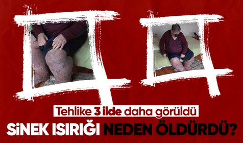 Bacaklarını fil gibi yapan sinek ısırığı neden öldürdü? 'Türkiye'de 3 ilde görülüyor'