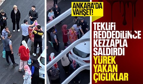 Ankara'da tüyler ürperten vahşet! Arkadaşlık teklifini kabul etmeyen iş arkadaşına kezzap attı! Kadının çığlıkları yürek yaktı