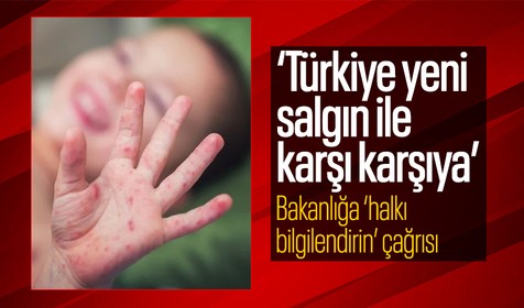 TTB'den Kızamık uyarısı: Hepimiz etkileneceğiz! Sağlık Bakanlığı toplumu kızamık hakkında bilgilendirmeli