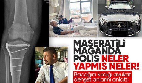 ‘Maserati’li polisin bacağını kırdığı avukat başından geçenleri anlattı: Bize dehşeti yaşattı