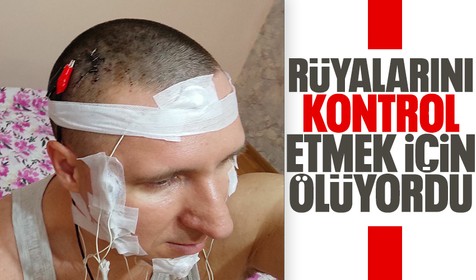 Rus adam kafatasını deldi! Rüyalarını kontrol etmek istiyormuş